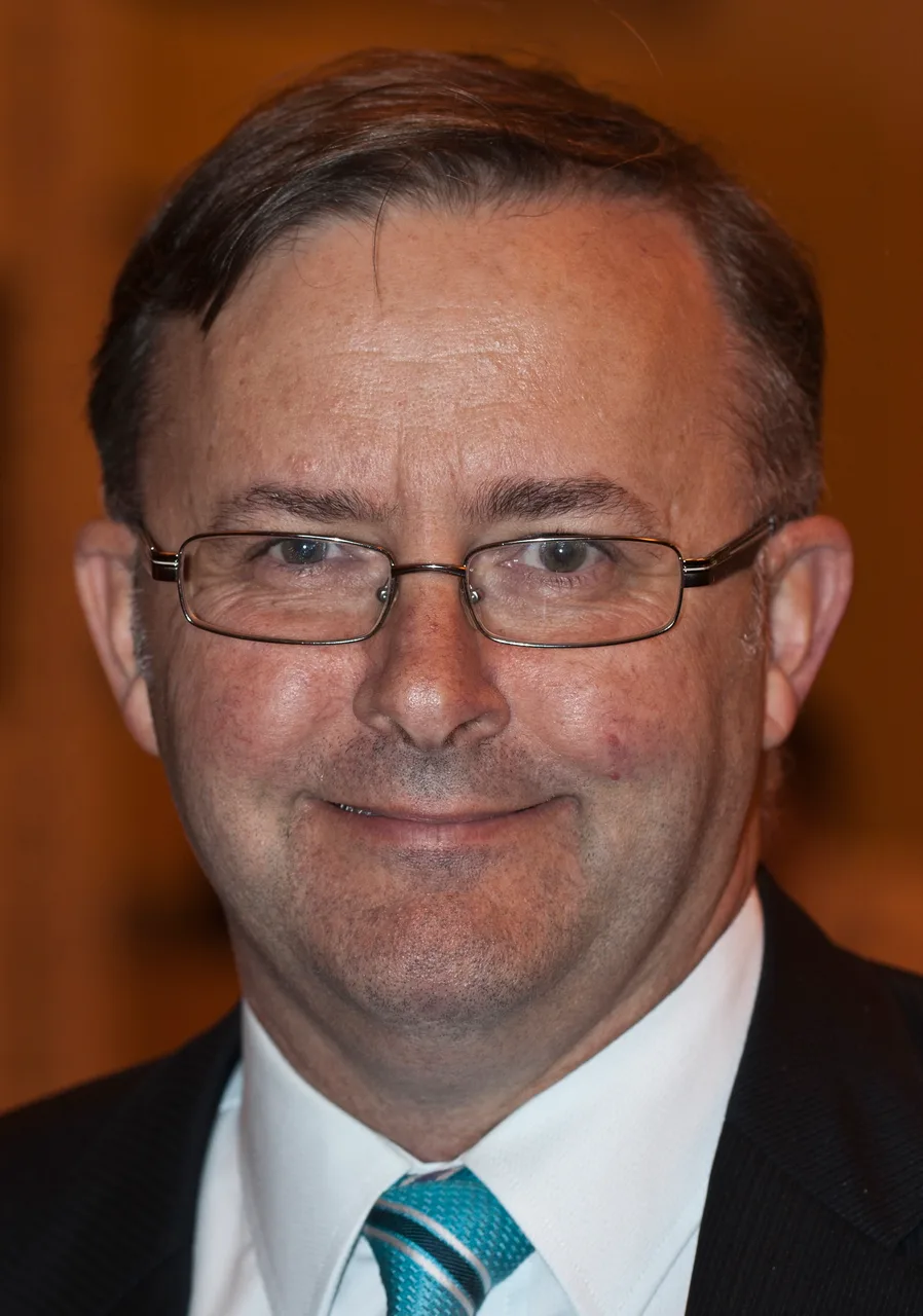 Anthony Albanese